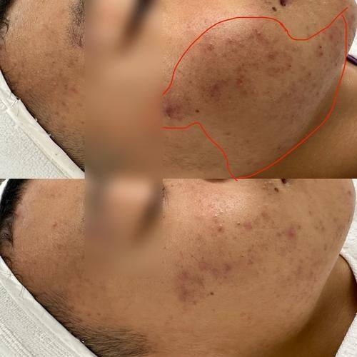 济南历城贝拉整形医院价格表: