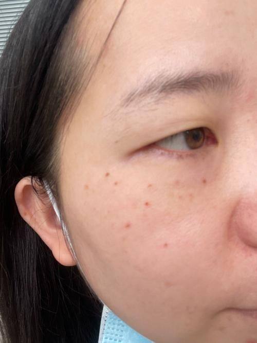 江阴红房子医院（医美中 心）价格表