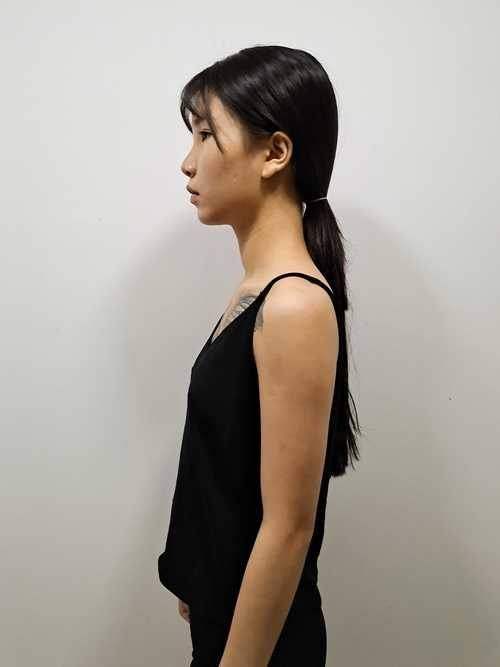 吴菲菲医生怎么预约