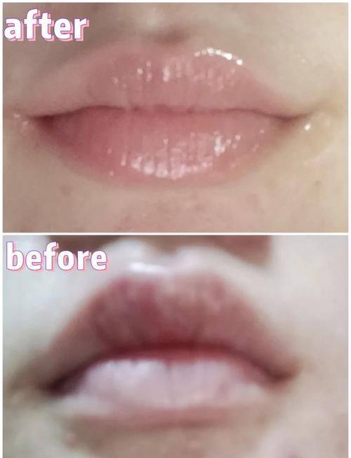 西安医学校第一附属医院(医学美容科)擅长项目：