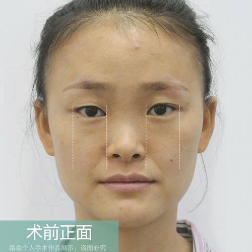 夏容容医生口碑评价