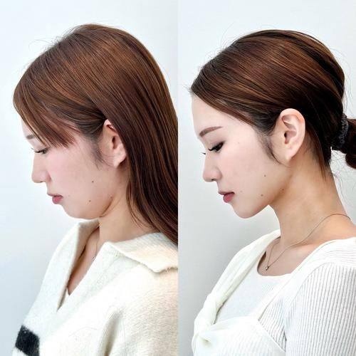 烟台莱阳珈晟三七美整形医院口碑评价