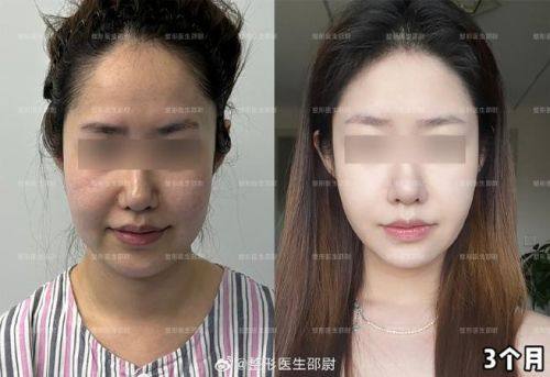 泰国Bangkok曼谷整形外科诊所擅长项目: