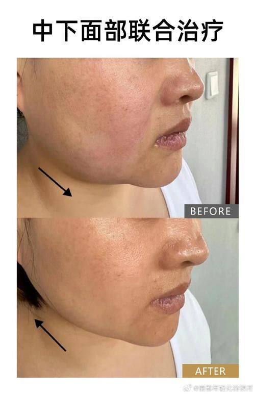 济南历城贝拉整形医院擅长项目: