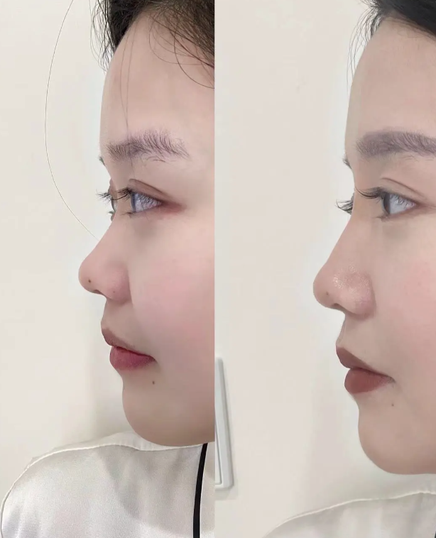 烟台莱阳珈晟三七美整形医院怎么样？