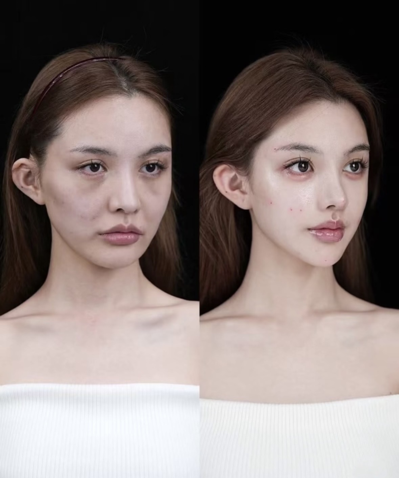 二、非手术类塑形方案