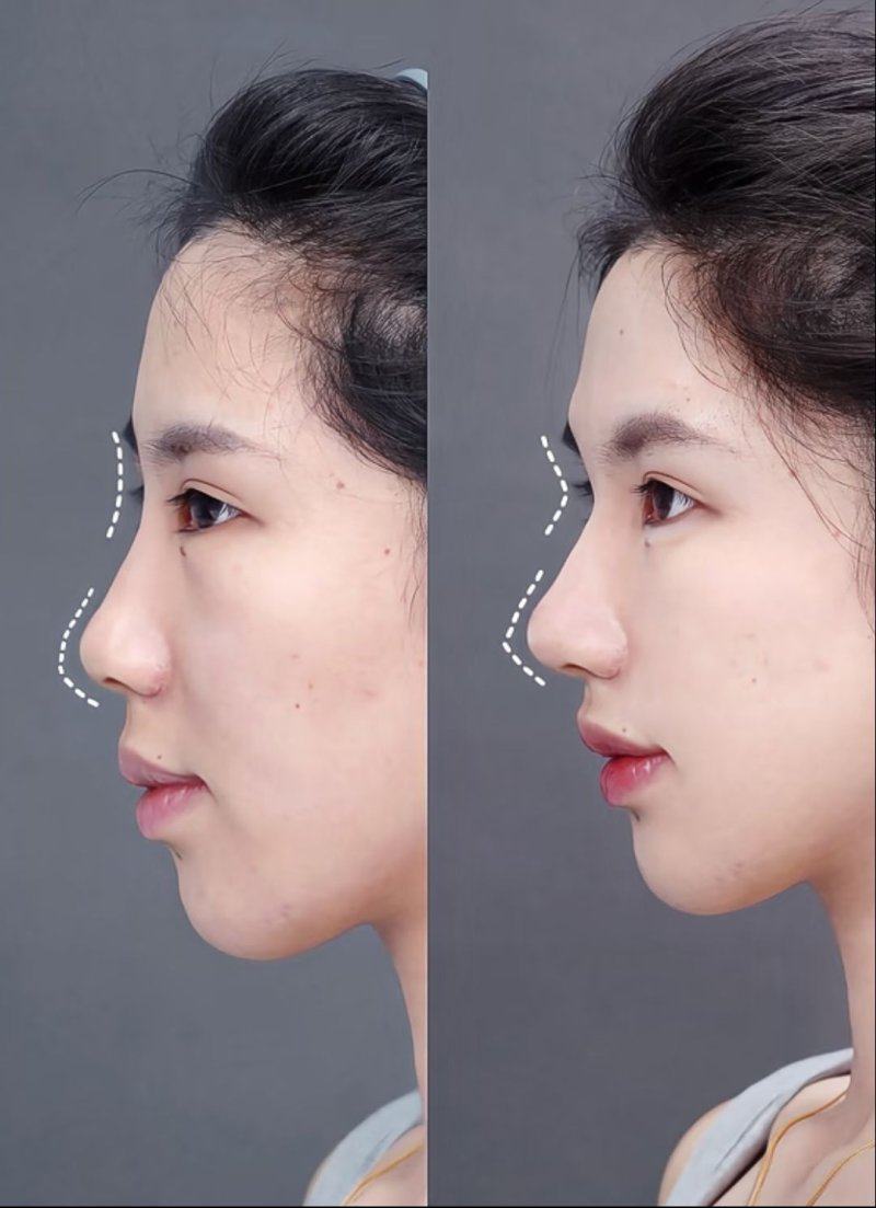 天津凤凰怡美整形美容医院价格表：