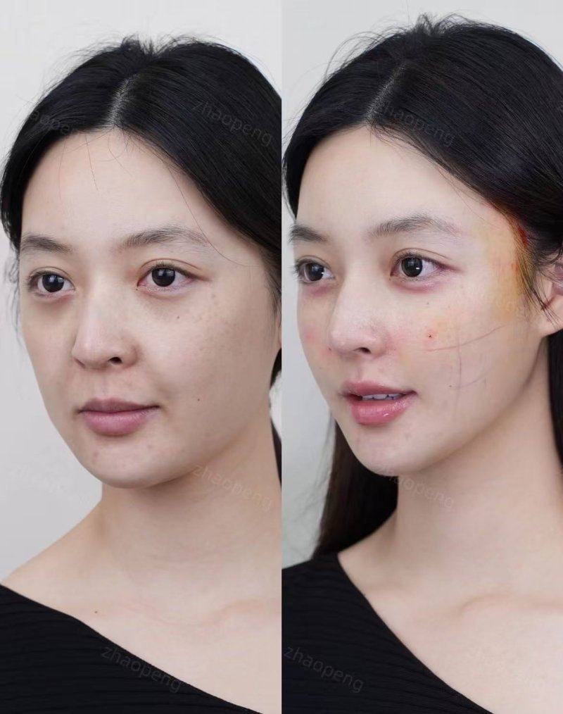 任忠亮医生怎么预约