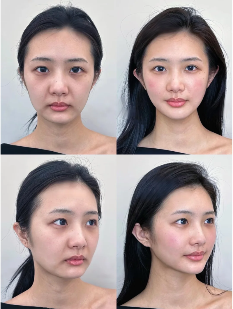 泰国Bangkok曼谷整形外科诊所预约挂号方式: