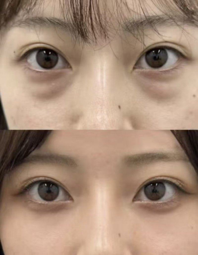 泰国Bangkok曼谷整形外科诊所怎么样?