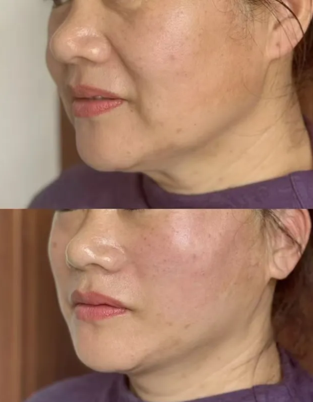 二、可优化手术时长的技术方案