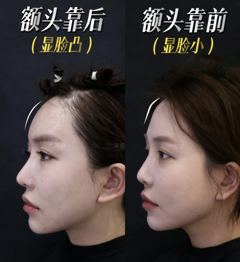 三、水动力吸脂的时长优化原理