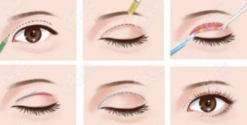 邱妍医生技术优势