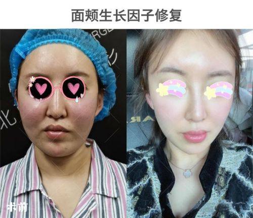 七、真实体验与避坑指南