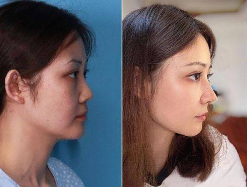 广州美聚源医疗整形美容怎么样？