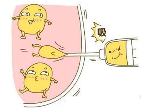 二、做腹部吸脂手术好吗多少钱