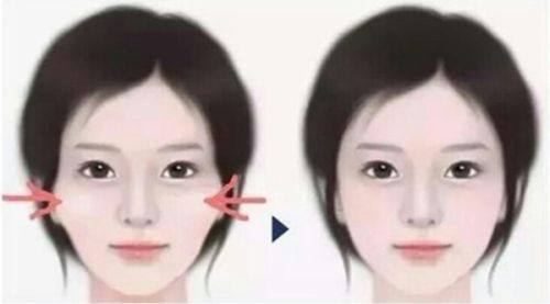 三、日常养护辅助淡化一年疤痕