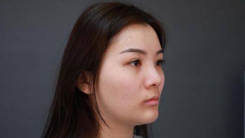 广州美聚源医疗整形美容口碑评价：