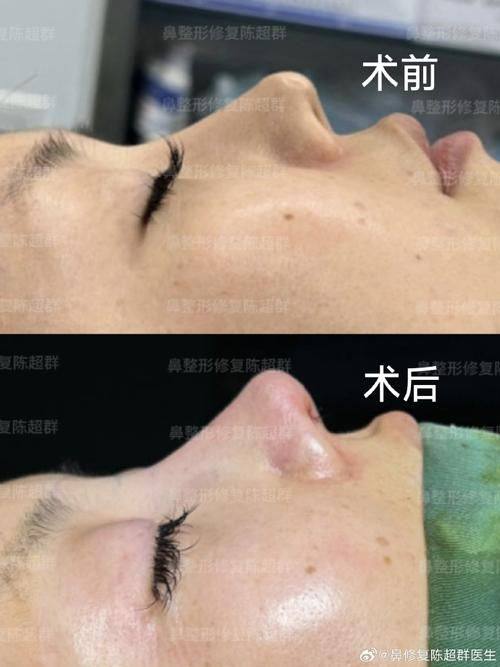 长沙奈嘉洛整形医院口碑评价: