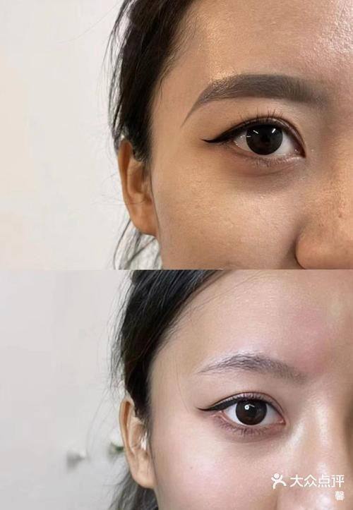 深圳龙岗东芳韵美医疗美容门诊部擅长项目