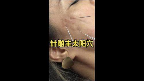 深圳龙岗东芳韵美医疗美容门诊部地址电话及营业时间