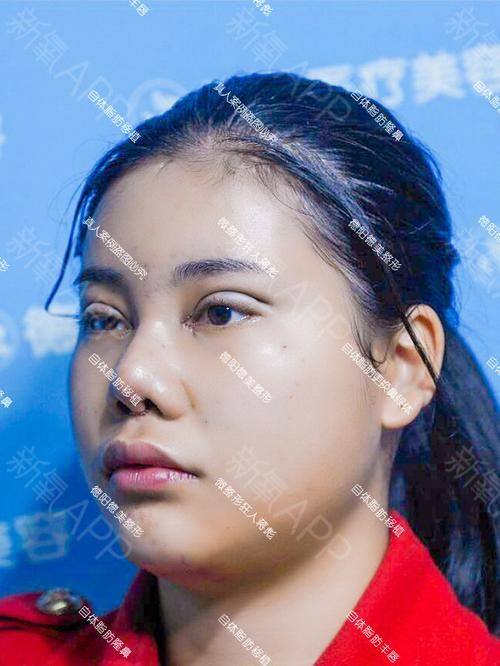 宁波云锦秀医疗美容诊所擅长项目: