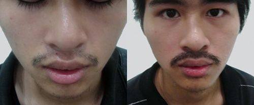 宁波云锦秀医疗美容诊所口碑评价: