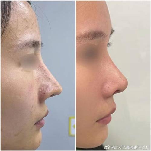 邱妍医生怎么预约