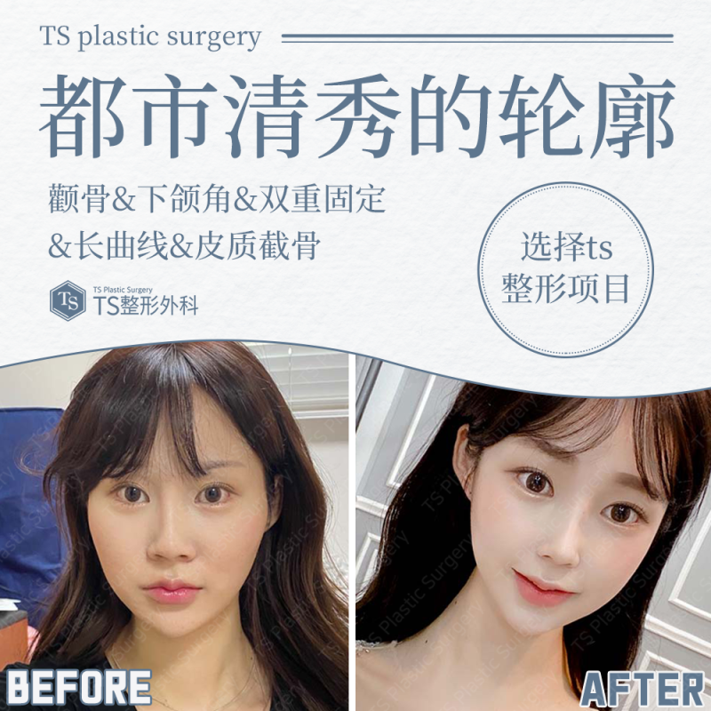 东阳市中医院烧伤整形科预约挂号方式：