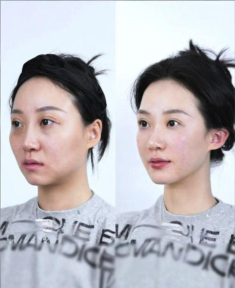 东阳市中医院烧伤整形科口碑评价：