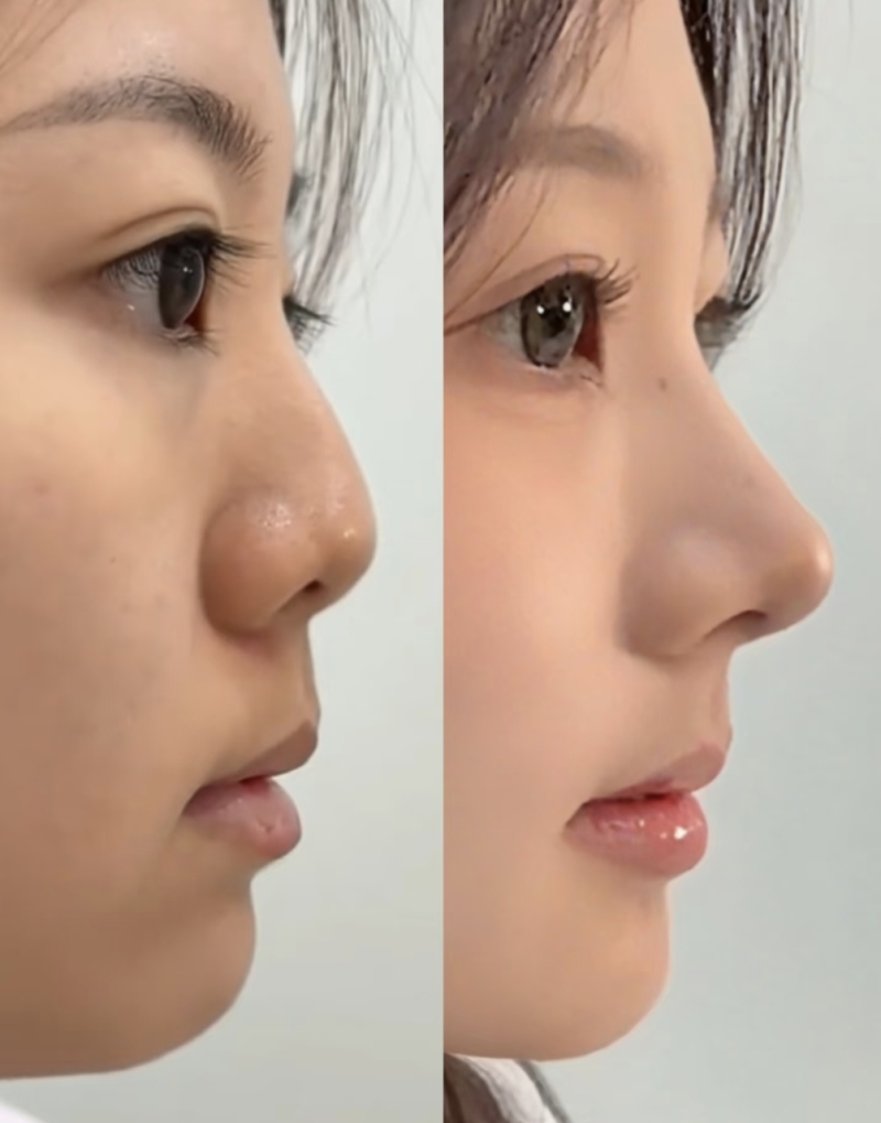 广州美聚源医疗整形美容价格表：