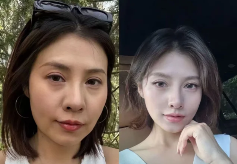 四、其他辅助祛疤手段