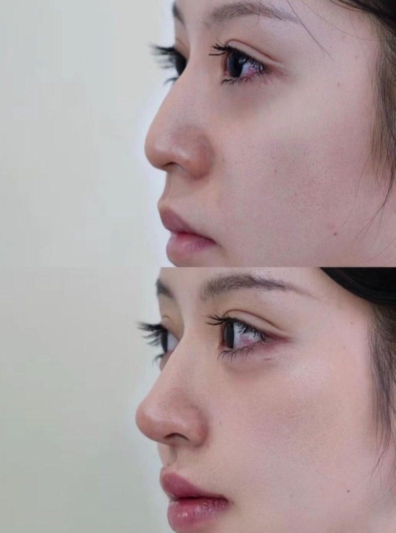 乌鲁木齐伊丽莎白医疗整形美容医院怎么样？