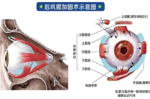 二、全切双眼皮14天可以画眼线吗
