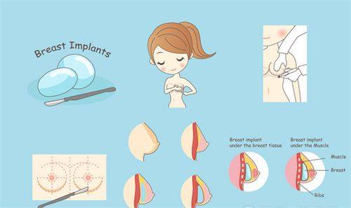 三、吸脂术后五厘米凹凸疤痕修复方案及费用