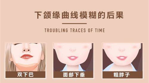 五、全切双眼皮术后化妆的通用注意事项