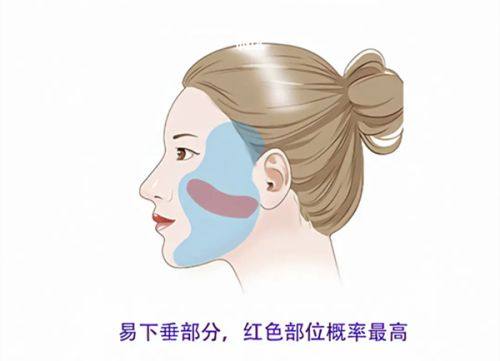 五、点阵激光去凸起疤痕的注意事项