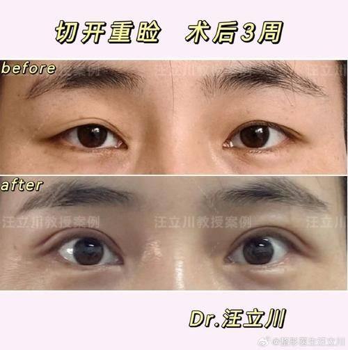 安徽芜湖二四美整形口碑评价：