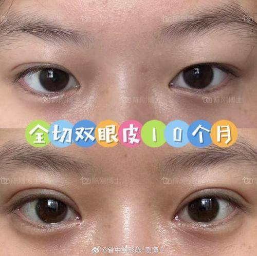 深圳亚太整形医疗美容门诊部擅长项目：