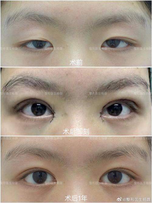 刘光磊医生口碑评价