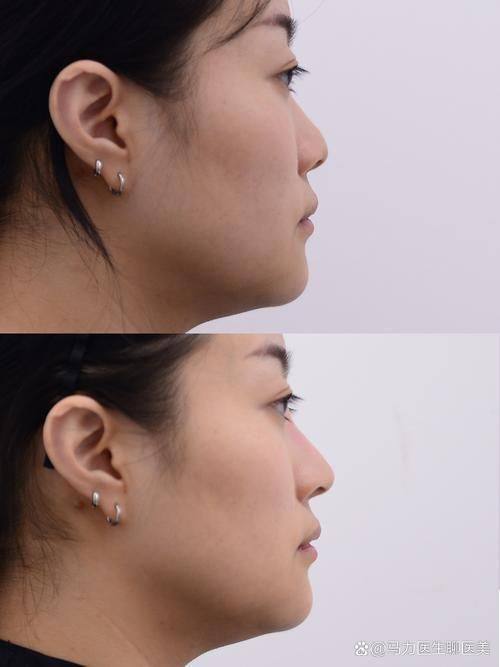 郑州二七妍琳医疗美容门诊部医生名单及擅长领域: