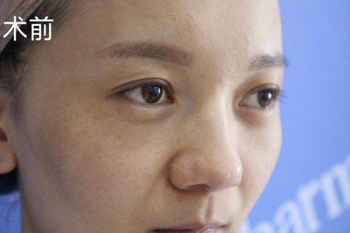 深圳博美医疗美容医院价格表