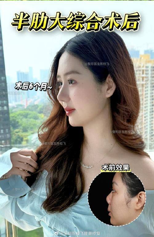 深圳博美医疗美容医院怎么样？