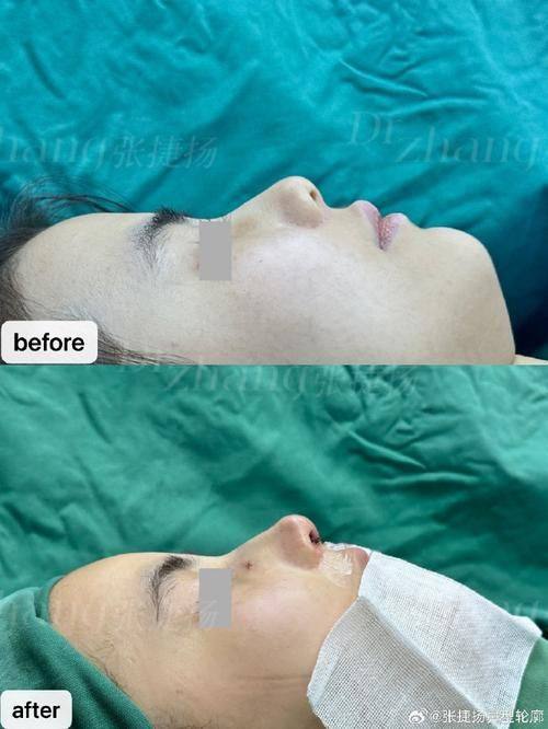 深圳博美医疗美容医院预约挂号方式