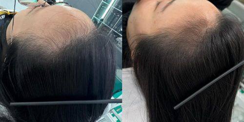 亳州市中医院皮肤科地址电话及营业时间：