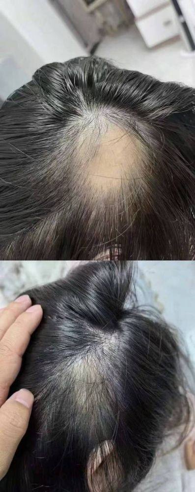 亳州市中医院皮肤科预约挂号方式：