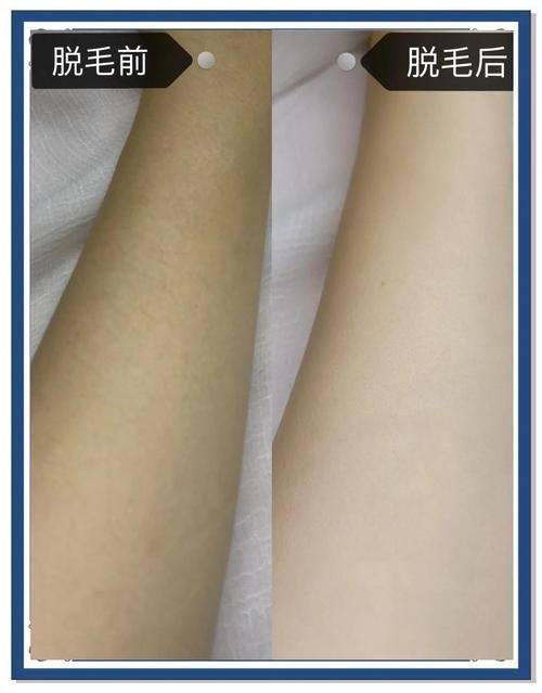 郑州二七妍琳医疗美容门诊部价格表