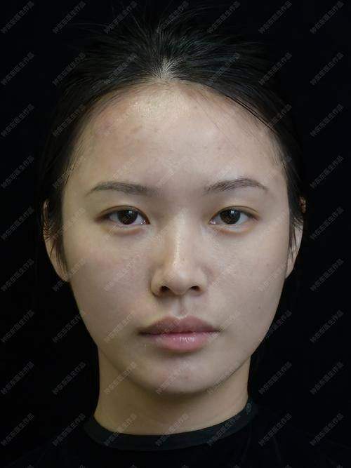 朱荣文医生怎么预约