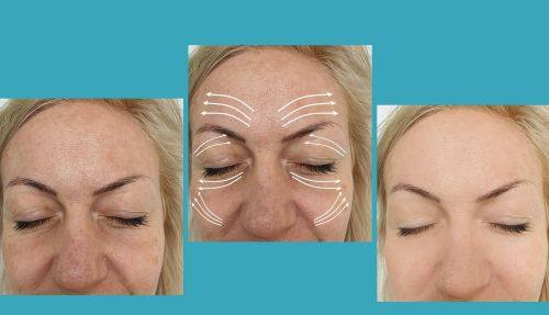 常宁越美整形美容医院擅长项目: