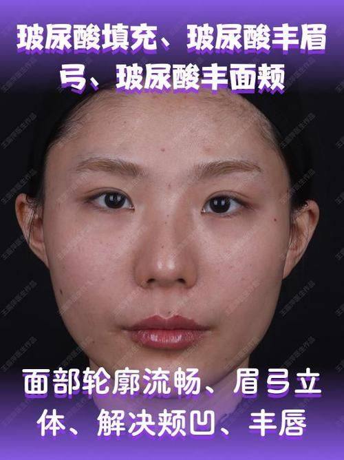 深圳博美医疗美容医院擅长项目